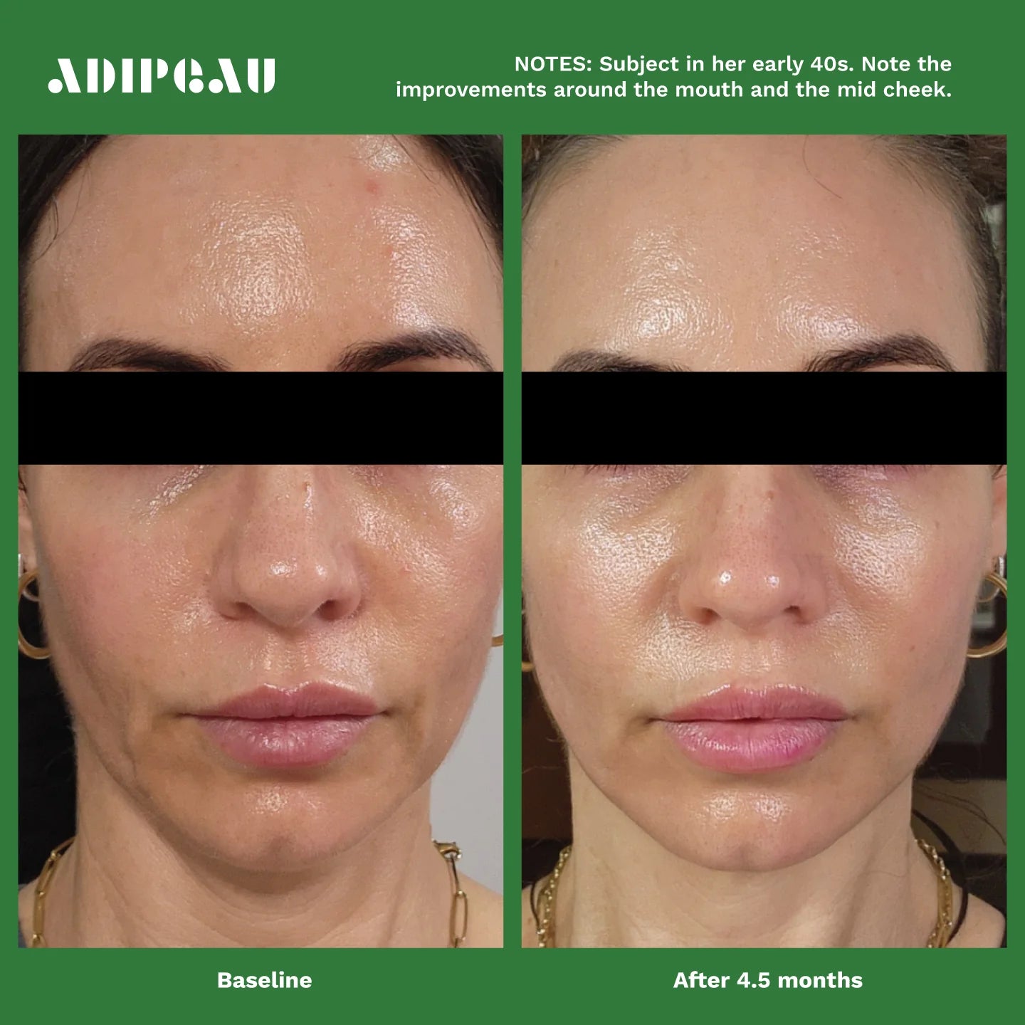 Adipeau Volume Cream