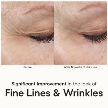 Plated SkinScience INTENSE Serum